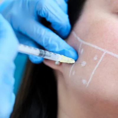 Botox tandenknarsen