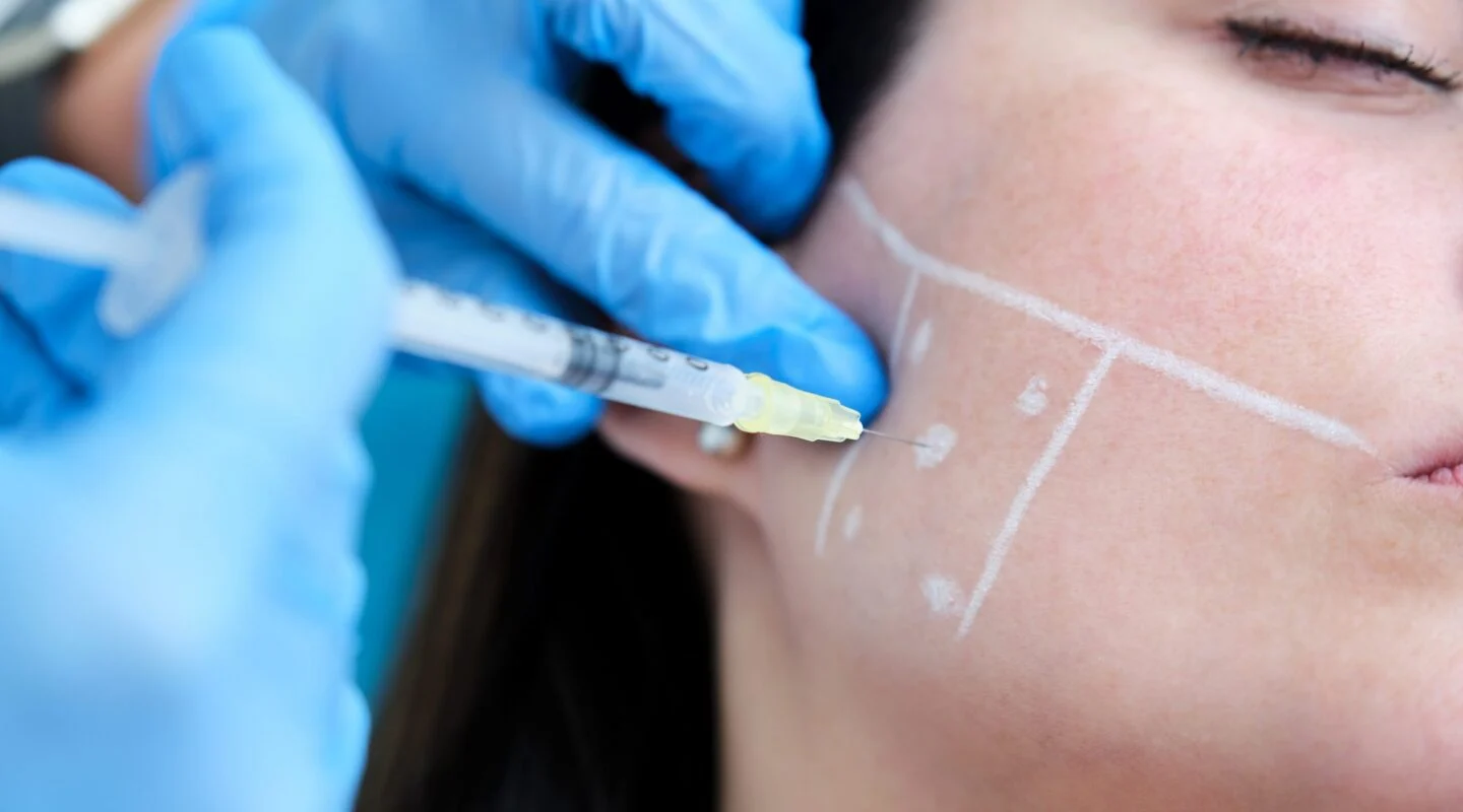 Botox tandenknarsen