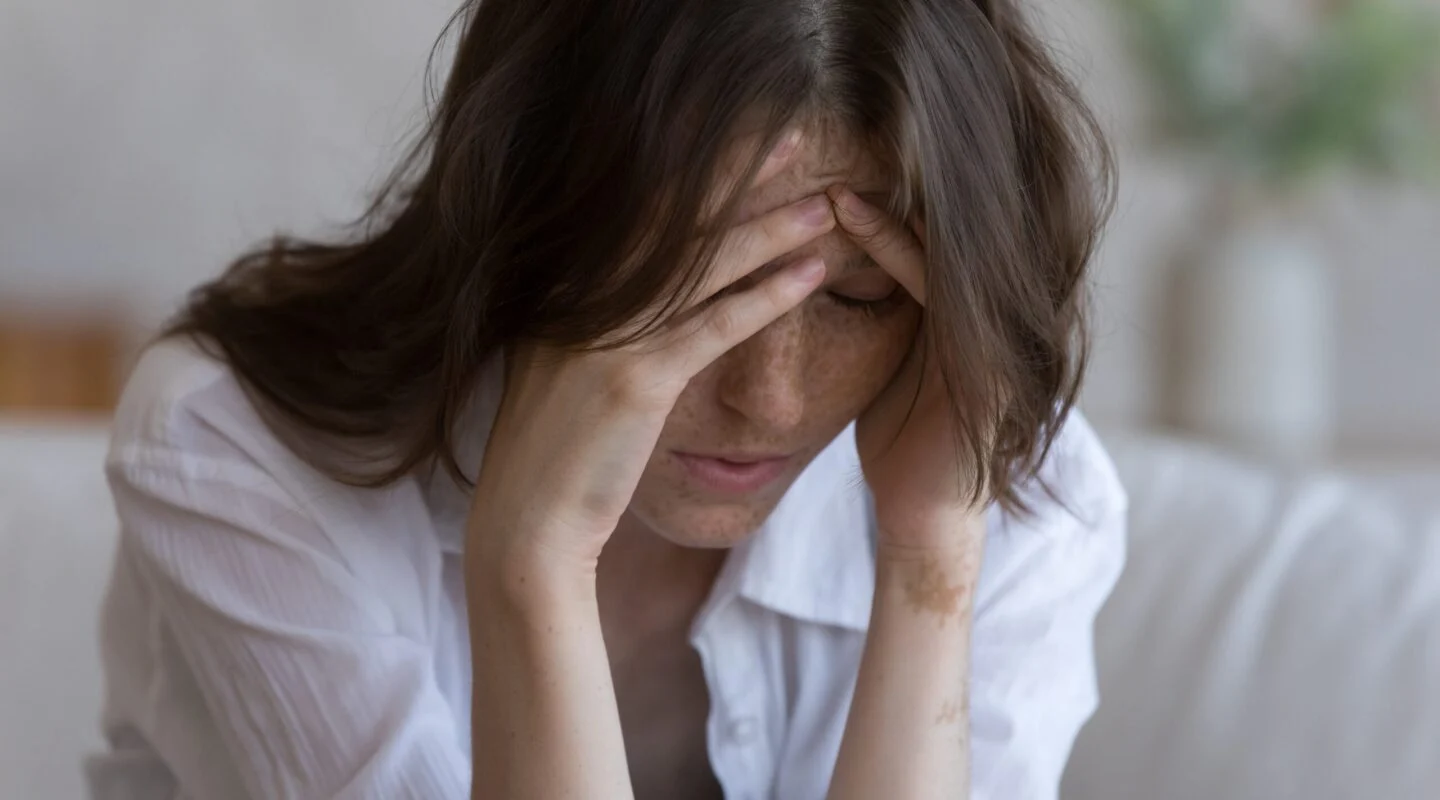 Botox Migraine
